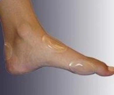 Pro-Tec Liquicell Blister Protectors - Small